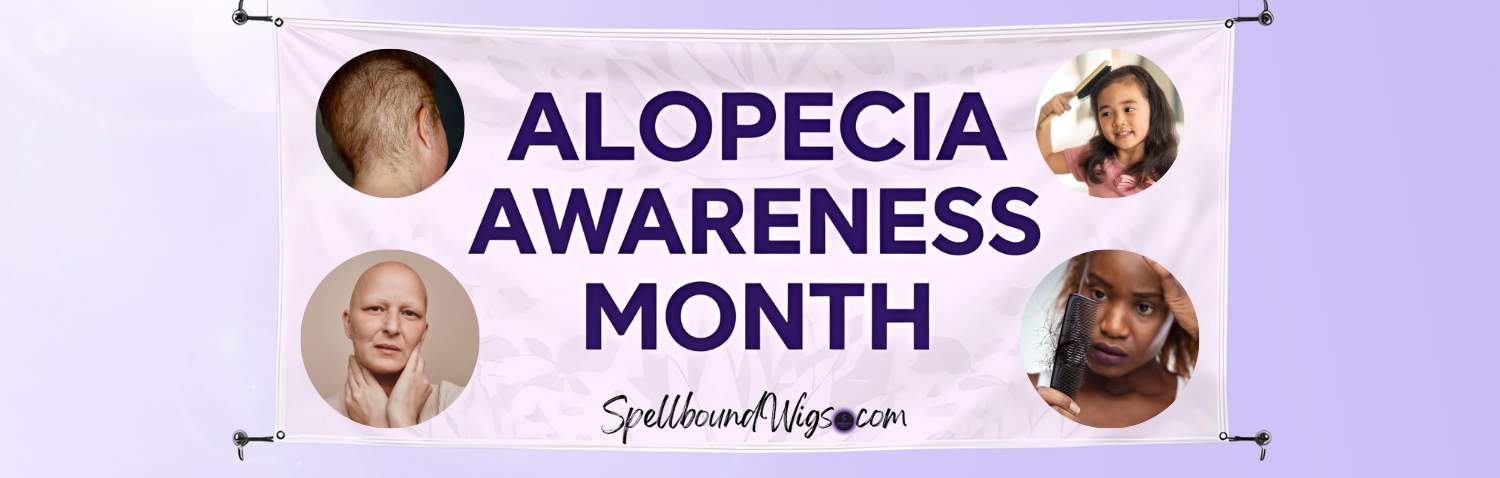 Alopecia Awareness Month ~ September 2025