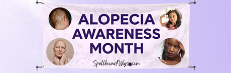 Alopecia Awareness Month ~ September 2025
